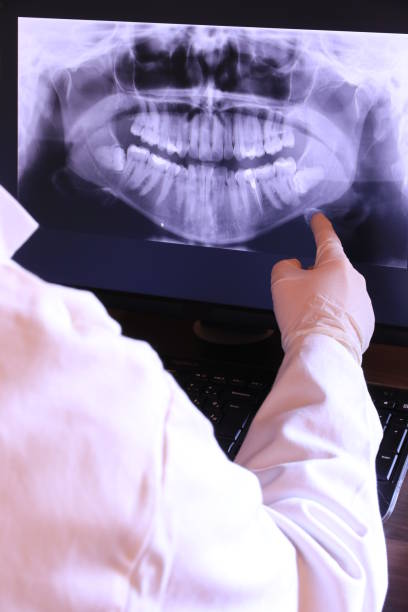 Best Emergency Dentist for Knocked-Out Tooth in Orangeburg, SC