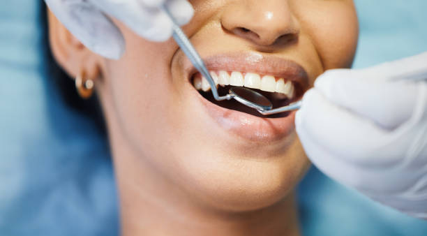 Best Pediatric Emergency Dentist in Orangeburg, SC